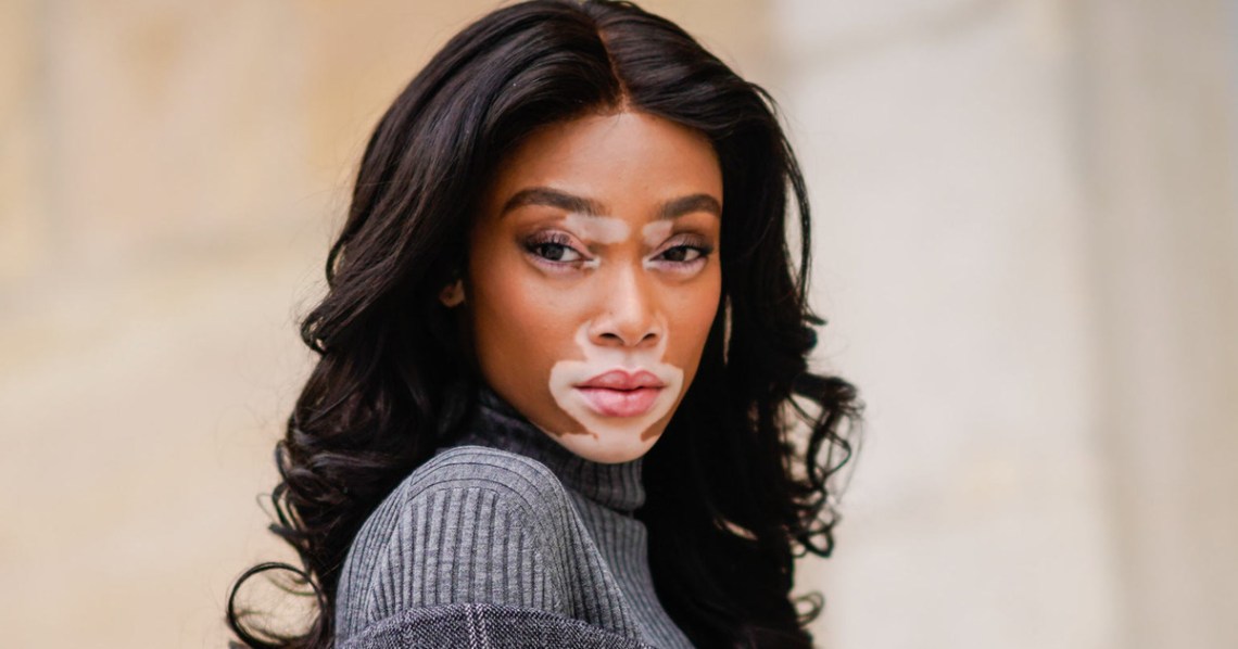 27-winnie-harlow.w1200.h630
